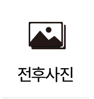 전후사진